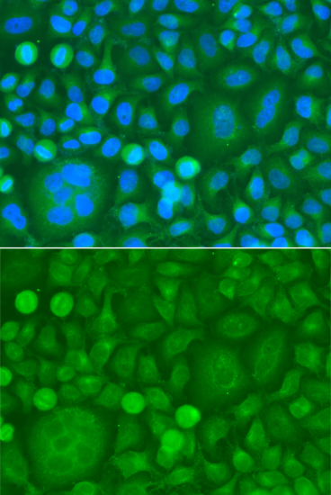 Anti-EPM2A Antibody (CAB7007)