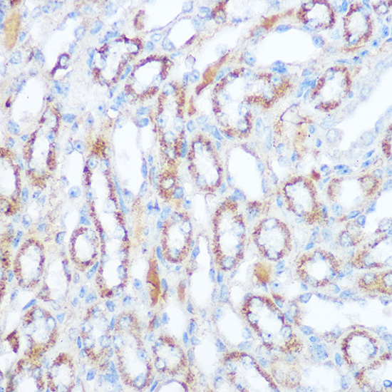 Anti-SIRT4 Antibody (CAB7585)