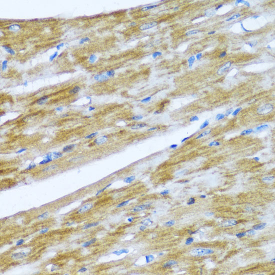 Anti-NMT1 Antibody (CAB16408)