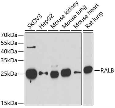 Anti-RALB Antibody (CAB6714)