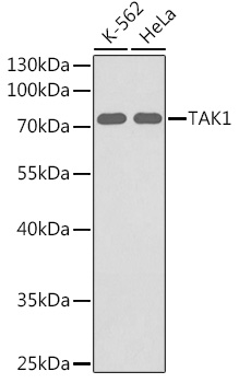 Anti-TAK1 Antibody (CAB0923)