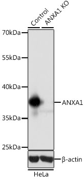 Anti-ANXA1 Antibody [KO Validated] (CAB1118)