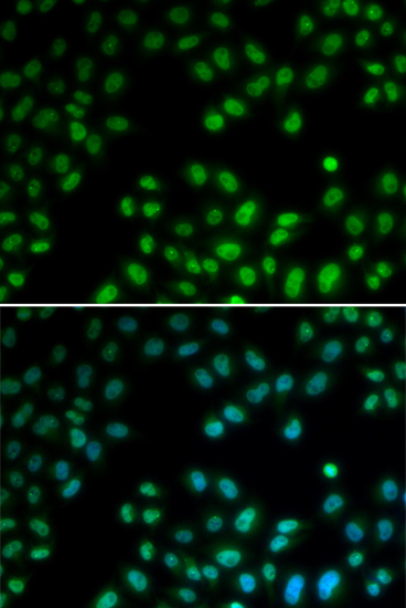 Anti-PIAS1 Antibody (CAB5729)