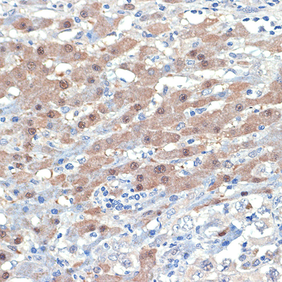 Anti-Smad4 Antibody [KO Validated] (CAB19116)