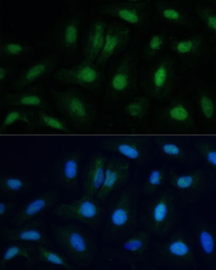 Anti-ETS2 Antibody (CAB7329)