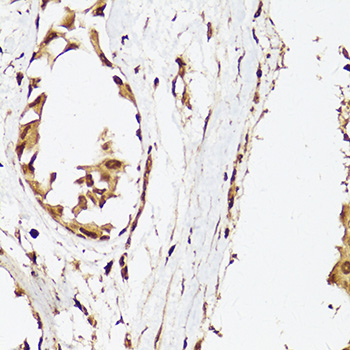 Anti-Androgen Receptor Antibody (CAB16200)