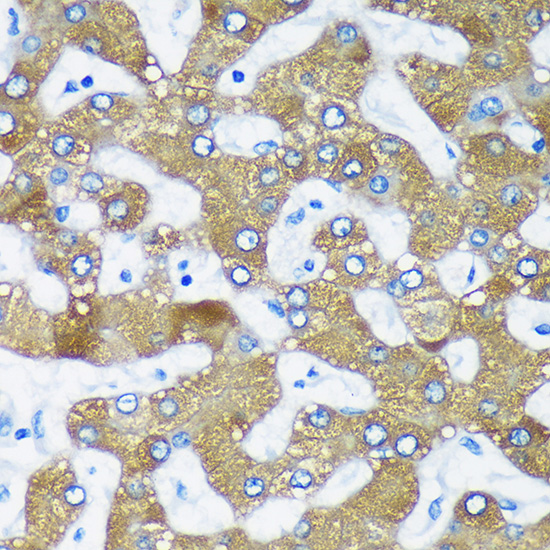 Anti-RMDN3 Antibody (CAB5820)