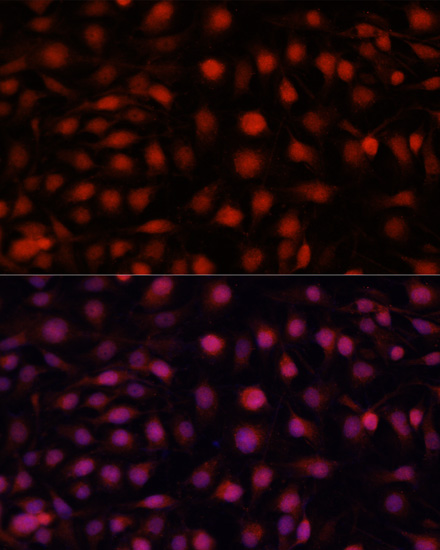 Anti-eNOS Antibody (CAB15075)