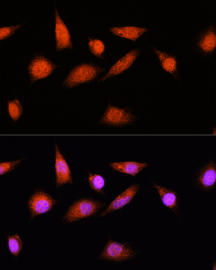 Anti-COPS8 Antibody (CAB12745)