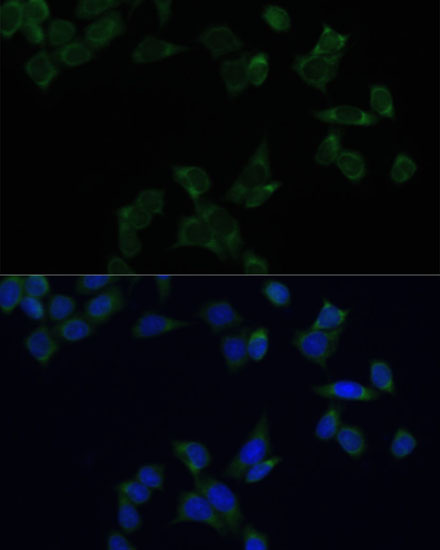 Anti-SS18L1 Polyclonal Antibody (CAB8822)