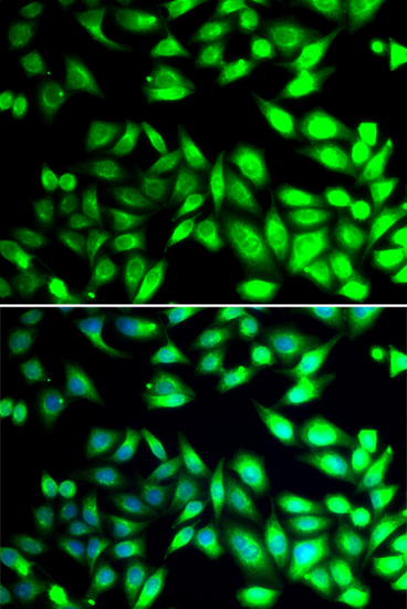 Anti-PDIA6 Antibody (CAB7055)