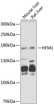 Anti-HFM1 Antibody (CAB12614)