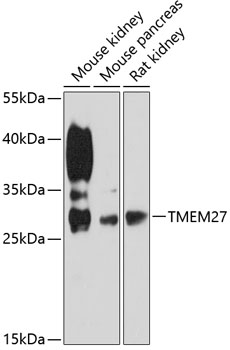 Anti-TMEM27 Antibody (CAB12715)