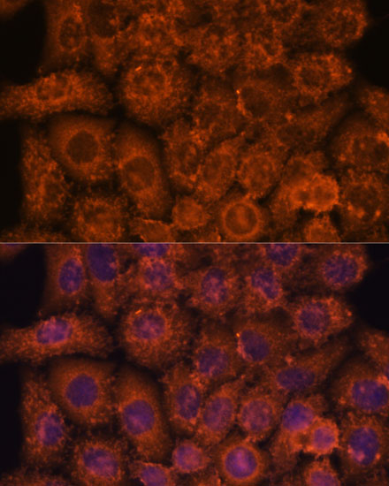 Anti-INMT Antibody (CAB14391)