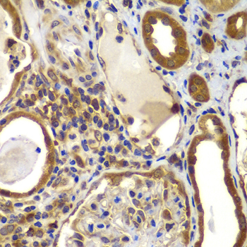 Anti-NME2 Antibody (CAB7443)