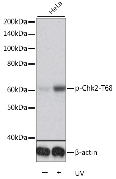 Anti-Phospho-CHEK2-T68 Antibody (CABP0590)