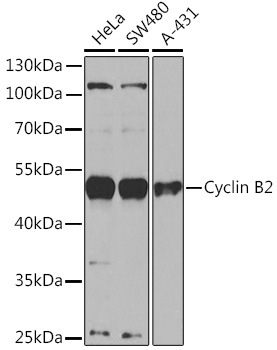 Anti-Cyclin B2 Antibody (CAB16463)