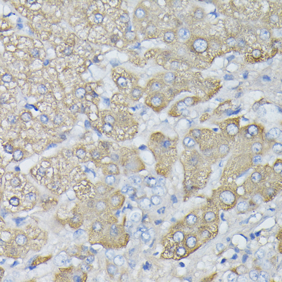 Anti-HP Antibody (CAB1571)