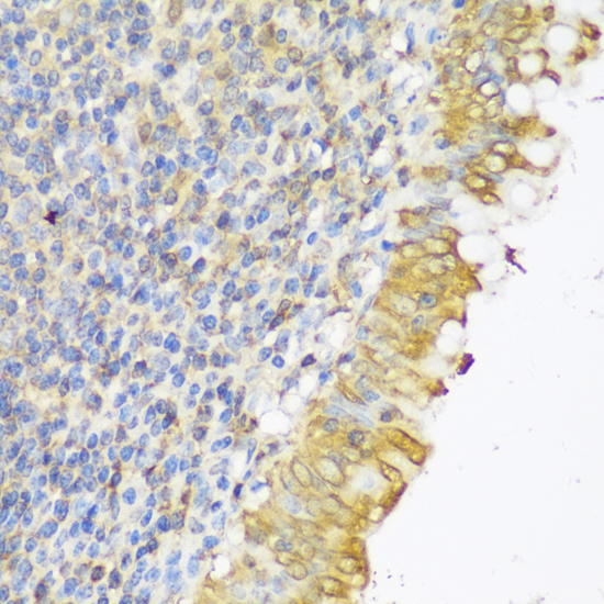 Anti-GLB1L3 Antibody (CAB14953)