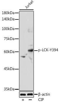 Anti-Phospho-LCK-Y394 Antibody (CABP0182)