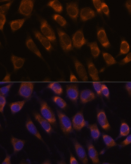 Anti-SEC61B Antibody [KO Validated] (CAB15788)