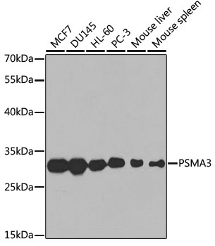 Anti-PSMA3 Antibody (CAB1245)