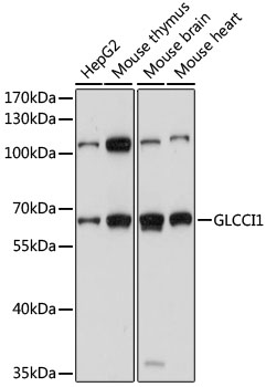 Anti-GLCCI1 Antibody (CAB15934)