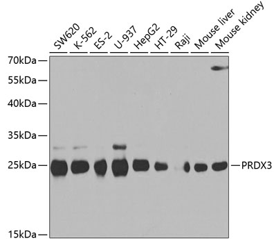 Anti-PRDX3 Antibody (CAB3076)