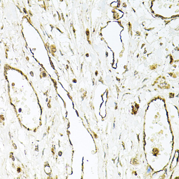 Anti-CD31/PECAM1 Antibody (CAB3181)