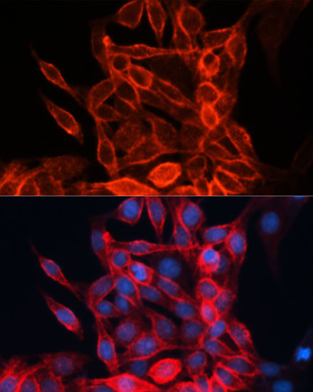 Anti-CD98 Antibody (CAB5702)