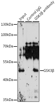 Anti-GSK3Beta Antibody [KO Validated] (CAB6164)