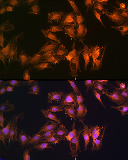 Anti-S100A14 Antibody (CAB10394)