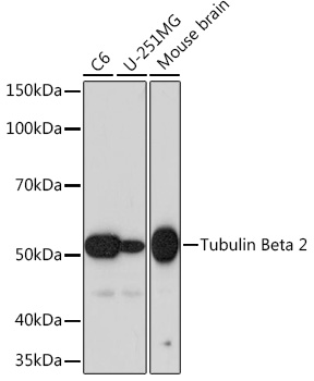 Anti-Tubulin Beta 2 Antibody (CAB4798)