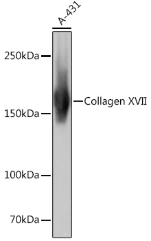 Anti-Collagen XVII Antibody (CAB4808)