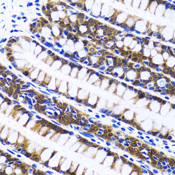 Anti-Fatty Acid Synthase Antibody [KO Validated] (CAB0462)