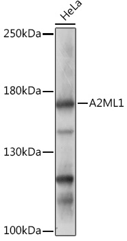 Anti-A2ML1 Antibody (CAB17831)