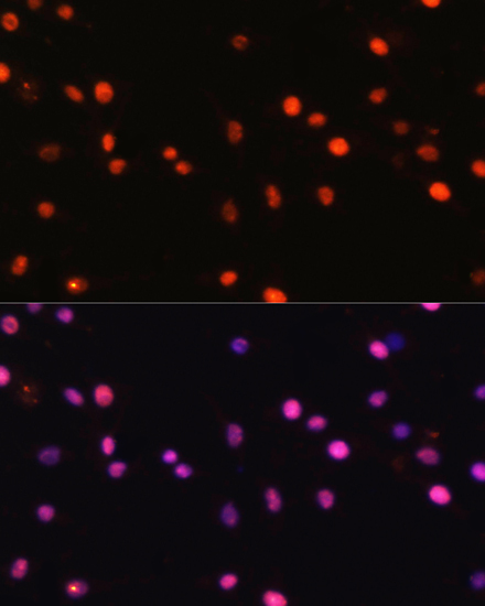 Anti-DNMT1 Antibody (CAB16729)