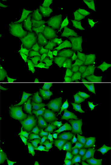 Anti-DFFA Antibody [KO Validated] (CAB1032)