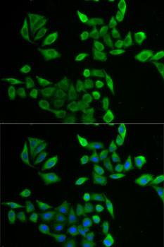 Anti-PNP Antibody (CAB14032)