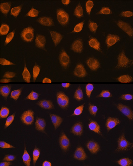 Anti-SEL1L Antibody (CAB12073)