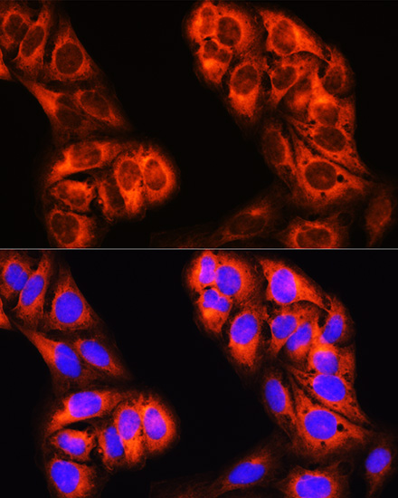 Anti-MTHFD1 Polyclonal Antibody (CAB8661)