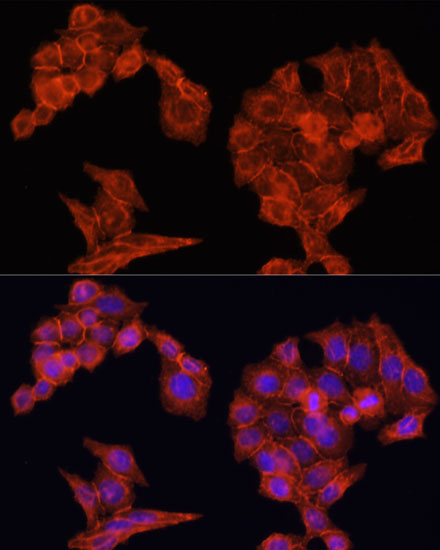 Anti-EGFR Antibody [KO Validated] (CAB11351)