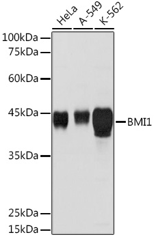 Anti-BMI1 Antibody (CAB0211)