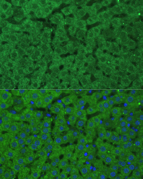 Anti-CBS Antibody (CAB1427)