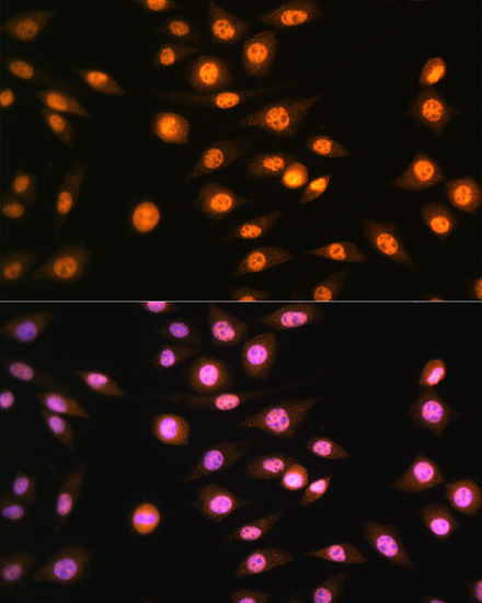 Anti-NR2F2 Antibody (CAB10251)