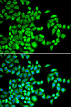 Anti-ALKBH1 Antibody (CAB14079)