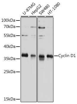 Anti-Cyclin D1 Antibody (CAB11310)