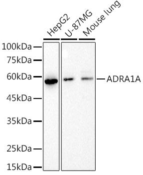 Western blot analysis of extracts of various cell lines, using at 1:1000 dilution. Secondary antibody: HRP Goat Anti-Rabbit IgG (H+L) at 1:10000 dilution. Lysates/proteins: 25ug per lane. Blocking buffer: 3% nonfat dry milk in TBST. Detection: ECL Basic Kit. Exposure time: 10s.