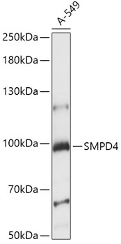 Anti-SMPD4 Antibody (CAB15473)