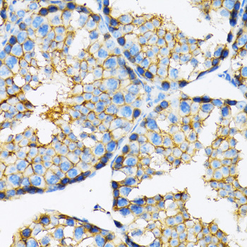 Anti-MCT1/SLC16A1 Antibody (CAB3013)